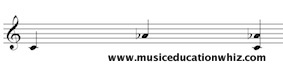 Melodic and Harmonic interval of a minor 6th (C to A flat) on the treble clef staff.